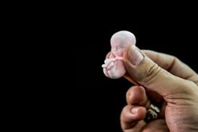 Aborto Criminoso VS. Aborto Legal